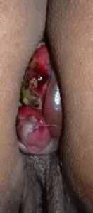 obat ambeien ampuh obat benjolan ambeien obat ambeien terbaik obat ambeien obat ambeien paling ampuh obat ambeien yang bagus rekomendasi obat ambeien obat ambeien susah BAB obat ambeien berdarah obat ambeien tanpa operasi ambefree obat nyeri ambeien obat ambeien dalam obat ambeien luar obat ambeien manjur obat bengkak ambeien obat pereda ambeien obat ambeien yang cepat sembuh obat ambeien alami ampuh obat ambeien mujarab