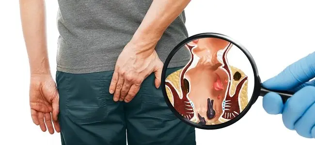 obat ambeien ampuh obat benjolan ambeien obat ambeien terbaik obat ambeien obat ambeien paling ampuh obat ambeien yang bagus rekomendasi obat ambeien obat ambeien susah BAB obat ambeien berdarah obat ambeien tanpa operasi ambefree obat nyeri ambeien obat ambeien dalam obat ambeien luar obat ambeien manjur obat bengkak ambeien obat pereda ambeien obat ambeien yang cepat sembuh obat ambeien alami ampuh obat ambeien mujarab