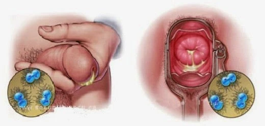 Obat Kencing Nanah
